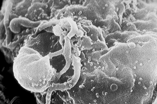 Black-and-white electron micrograph of a lymphocyte's rounded, knobbly surface dotted with tiny round bumps, the sites where virus particles assemble and bud.