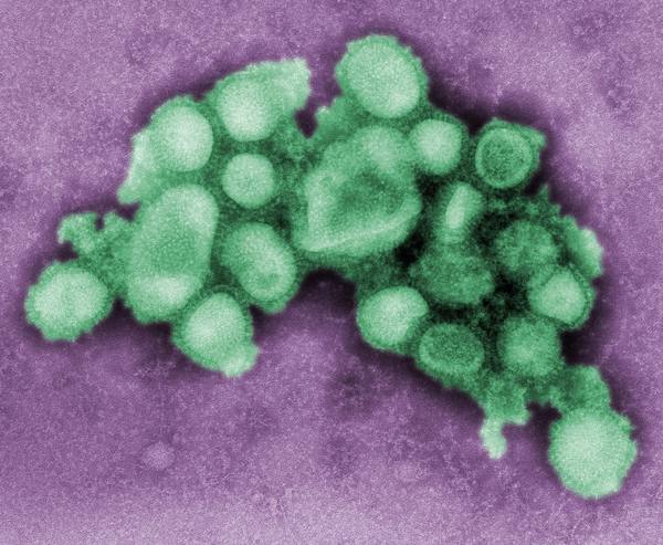 A cluster of rounded virus particles colored green against a purple background, seen at very high magnification.